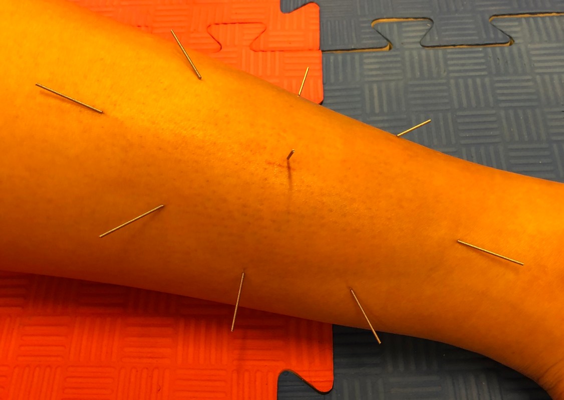 0B542054-041A-4F03-B4A5-5C1D60EA3CFA_1_201_a